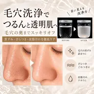 水素水で毛穴洗浄✨黒ずみ・角栓すっきり毛穴ケア