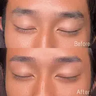 眉毛WAX脱毛
