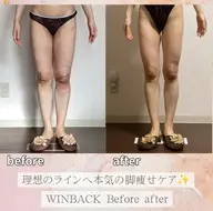 【人気No.1】冷え、ハミ肉、ポッコリお腹/痩身！ラジオ波WINBACK×最強リンパ（上半身or下半身）90分