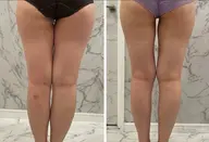 全身筋膜コース《痩身》　一度で効果を体験したい方にオススメ！お身体引き締めと痩せやすい身体作りを実現◎