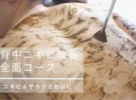 【ブライダル/式前ケア/背中ニキビケア】ハーブピーリング背中全体