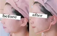 【人気No.1】【たるみ・老け顔解消🔥】切らない➕痛くない引き上げリフト&小顔フェイシャル　60分