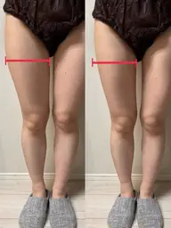 【韓国発🇰🇷最新レッドショット💉🩸】足の練習モニター様募集中🌟 4cc〜6ccによってお値段変動あり💫