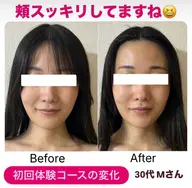初回体験価格!モニタープラン② トライアングルフェイシャル®️