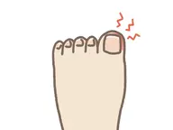 陥入爪補正