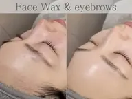 【モニター価格】ツヤ肌毛穴レス◇フルフェイスWAX脱毛(美眉デザイン+毛量調整)