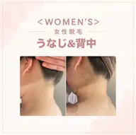【女性脱毛】実はみられてるあ!うなじ&背中似合わせシェービング付き