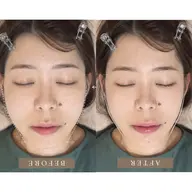 小顔美肌へ✨小顔矯正×毛穴洗浄×ヘッドスパ 【エラ/左右差/むくみ/凝り】