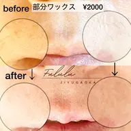 【ミニモ限定】選べる部分ワックス一部位2000円 ※鼻毛のみは1500円サクッと綺麗に✨女性限定