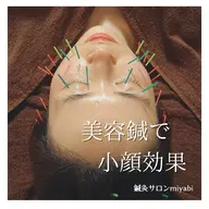 本気の方専用🔥美容鍼×エステ🔥１ヶ月集中モニター🔥小顔リフト美顔鍼×血巡りエステ┃小顔・むくみ・眼精疲労