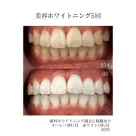 【初回お試し1.980円メニュー】美容ホワイトニング→不安な方向け