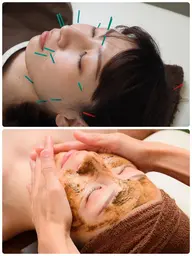 【👑最強👑】ハーブピーリング➕美顔鍼💎90分