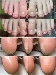 足裏つるつる角質ケア+甘皮ケア+爪形整え