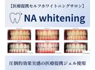 当日限定!ホワイトニング🦷