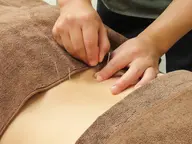 鍼施術