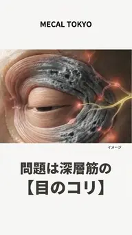 そのクマ、老け見えしてるその目、疲れてるだけで終わらせる?20代から始めるデコルテ〜頭 目元集中ケア。始めるなら今!