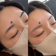 【初回限定】間引き ∣ 眉の濃さが気になる方 ∣ 6500円