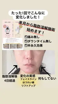 (初回)小顔フェイシャル！二重アゴ撃退メニュー！