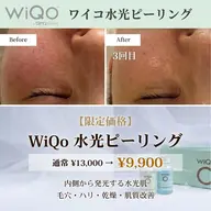 【ハリ・ツヤ・毛穴】浸透型ピーリングでコラーゲン促進🌱保湿ケアも◎エレクトロポレーション&パック付き