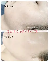 フェイシャルワックス(顔全体・パック付き)