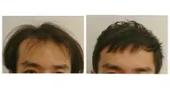 男性限定、薄毛ケアのショートカットモデル