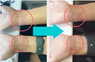 肌質改善短時間メニュー