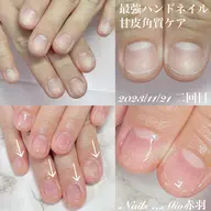 💅深爪改善クリアジェル90分コース