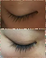 【まつ毛&フェイシャルエステ】目元も引き上がるフェイシャルエステ付き