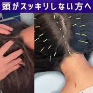 【秋の寒暖差・眠りが浅い方に】あたまの鍼×首肩こり集中鍼×熟睡ヘッドマッサージ 50分
