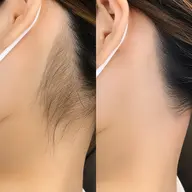 うなじワックス