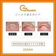 〔foot〕巻き爪ケア(2本まで)