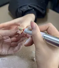自爪オフのみ ケア付き
