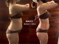 【全身痩せ🔥機械60分】モニター様価格🦵🏼