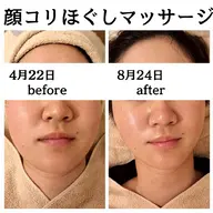 【毛穴/小顔/食いしばり】小顔マシン+毛穴洗浄&血流リンパマッサージ+顔ほぐしマッサージ+美容液導入 80分