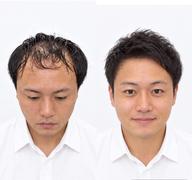 スタンダードカット＋縮毛矯正