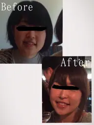 🎃10月限定ハロウィンキャンペーン🎃劇的小顔フェイシャル✨ ⭐️1ヶ月以内2回施術分