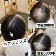 ヘアジェンヌ2000本