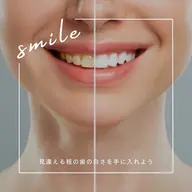 【✨☂️梅雨でも爽やか笑顔✨】残り17/20名限定❕人気No.1ホワイトニング45分【¥8980→¥2000】 👑