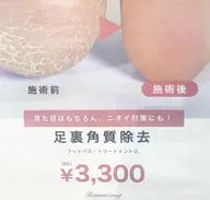 🪽気になる臭い・カサカサ改善 角質ケア🪽 赤羽