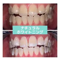 【期間限定メニュー】何と!会員級の合計40分照射!