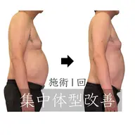 【楽痩せ!】体の機能・骨格・脂肪へ全方位アプローチ★高周波美容整体180分