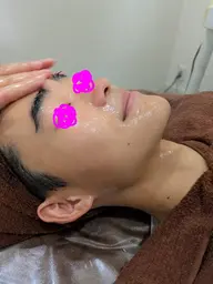 ニキビ、毛穴コース(メンズOK)
