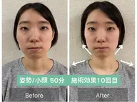 《Googleロコミ投稿お約束》《20代〜30代限定》小顔整体骨盤整体+悩み別メニュー50分15900円→0円
