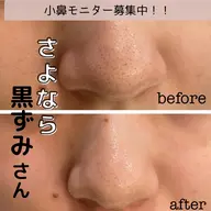 《6/1～6/8までエステモニター募集中》気になるパーツだけの小鼻の毛穴すっきりエステ👃現金払いのみ