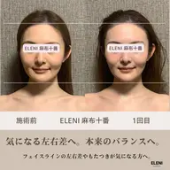 🎁口コミ投稿で施術10分延長🎁リフトアップ・左右差・エラ張り改善◎👑人気No.1★小顔矯正+全身整体90分