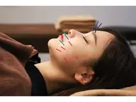美容施術【ご新規期間限定✨】8900→2500