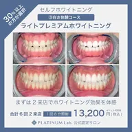 【新規様限定】ライトプレミアムセルフホワイトニング30分×2来店 合計60分🦷✨
