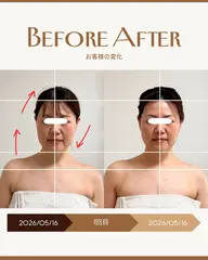 🌿 3ヶ月間(6回来店条件)90分【顔の左右差解消/首や頭のねじれ解消小顔ヘッドスパ】