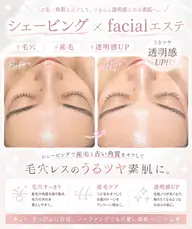 ミニモセール24歳以下限定☆美顔パーフェクト脱毛☆美白/毛穴/くすみ/保湿¥1980