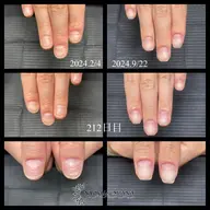 美爪へ導く自爪育成★爪質改善